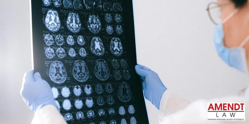 best traumatic brain injury lawyer in pomona